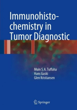 Kniha Immunohistochemistry in Tumor Diagnostics Muin S. A. Tuffaha