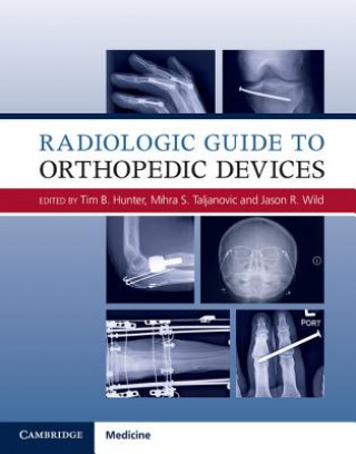 Könyv Radiologic Guide to Orthopedic Devices Tim B. Hunter