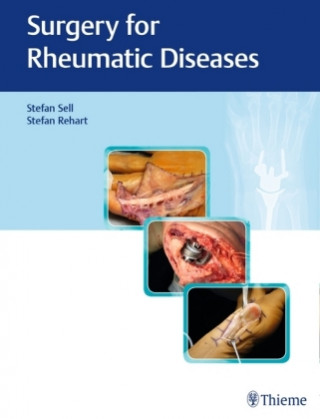 Könyv Surgery for Rheumatic Diseases Stefan Sell
