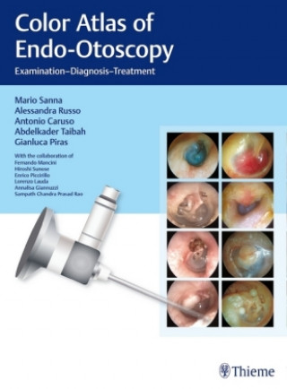 Книга Color Atlas of Endo-Otoscopy Mario Sanna
