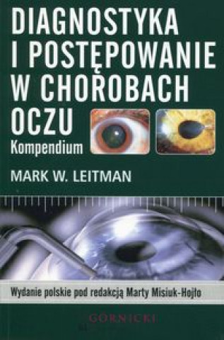 Kniha Diagnostyka i postepowanie w chorobach oczu Mark W. Leitman