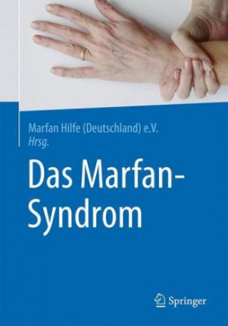 Knjiga Das Marfan-Syndrom Marfan Hilfe (Deutschland) e.V.