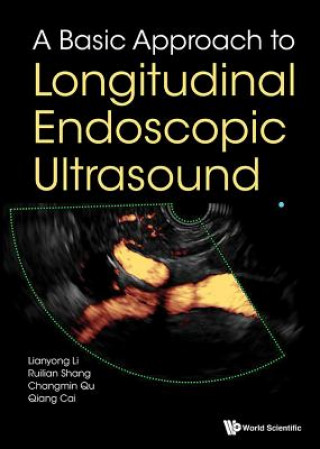 Książka Basic Approach To Longitudinal Endoscopic Ultrasound, A Qiang Cai