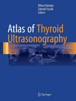Könyv Atlas of Thyroid Ultrasonography Milan Halenka