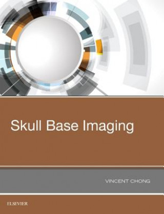 Buch Skull Base Imaging Vincent Chong