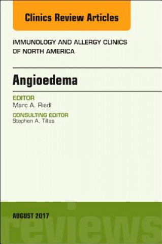 Kniha Angioedema, An Issue of Immunology and Allergy Clinics of North America Riedl