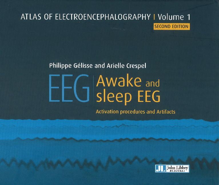 Könyv Atlas of Electroencephalography Philippe Gelisse