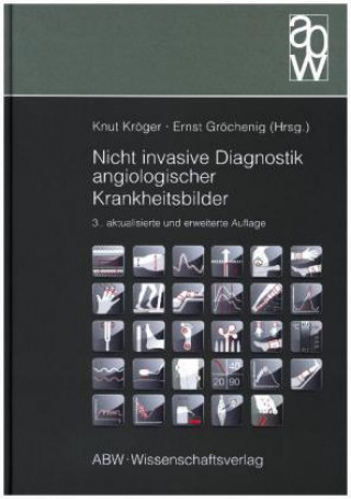 Kniha Nicht invasive Diagnostik angiologischer Krankheitsbilder Knut Kröger