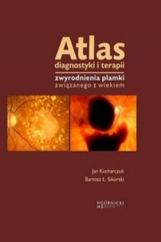 Kniha Atlas diagnostyki i terapii zwyrodnienia plamki zwiazanego z wiekiem Jan Kucharczuk