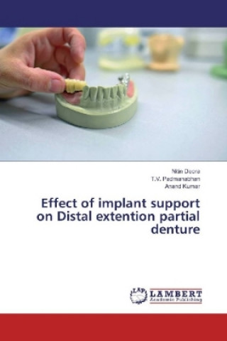 Carte Effect of implant support on Distal extention partial denture Nitin Deora