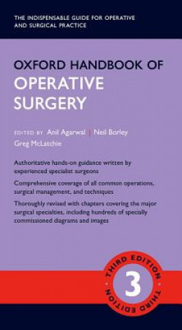 Kniha Oxford Handbook of Operative Surgery A  ED ET AL AGARWAL