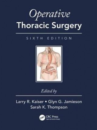 Kniha Operative Thoracic Surgery Larry R. Kaiser