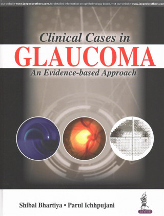 Kniha Clinical Cases in Glaucoma Shibal Bhartiya