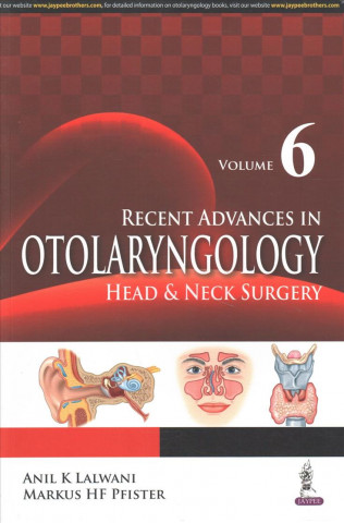 Carte Recent Advances in Otolaryngology Head & Neck Surgery Anil K. Lalwani
