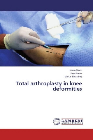 Kniha Total arthroplasty in knee deformities Liliana Savin