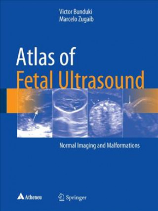 Kniha Atlas of Fetal Ultrasound Victor Bunduki