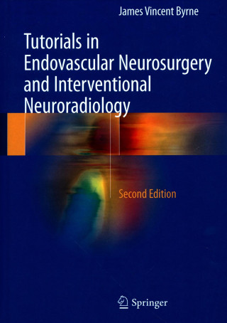 Carte Tutorials in Endovascular Neurosurgery and Interventional Neuroradiology James Vincent Byrne
