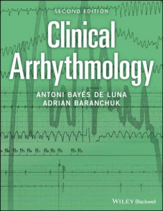 Knjiga Clinical Arrhythmology, 2nd Edition Antoni Bayes de Luna