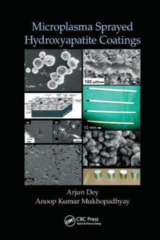 Book Microplasma Sprayed Hydroxyapatite Coatings DEY