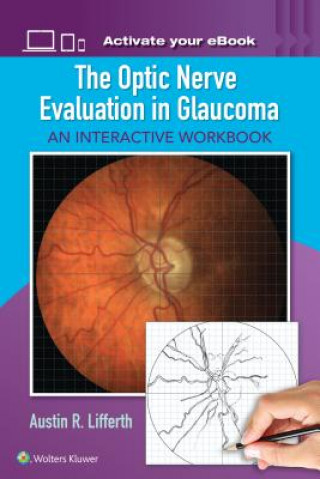 Книга Optic Nerve Evaluation in Glaucoma Austin Lifferth