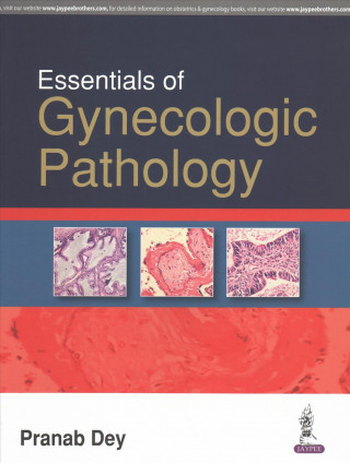 Book Essentials of Gynecologic Pathology Pranab Dey