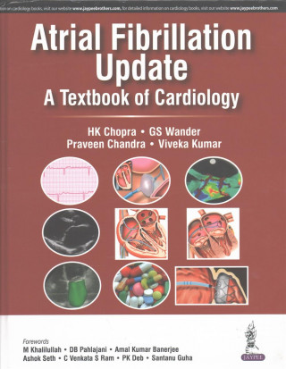 Kniha Atrial Fibrillation Update: A Textbook of Cardiology HK Chopra