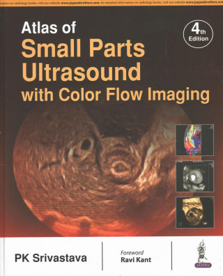 Book Atlas of Small Parts Ultrasound PK Srivastava