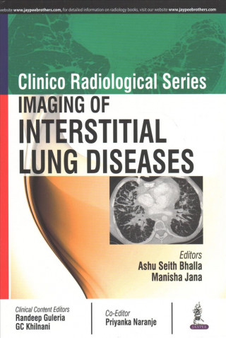 Kniha Clinico Radiological Series: Imaging of Interstitial Lung Diseases Ashu Seith Bhalla