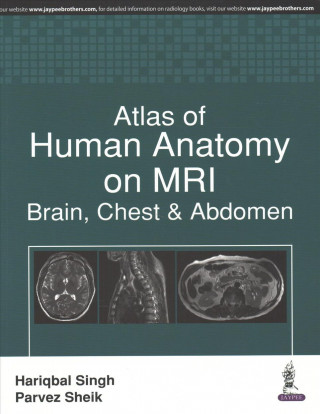 Kniha Atlas of Human Anatomy on MRI Hariqbal Singh