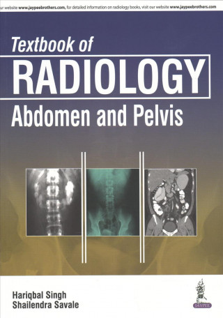 Kniha Textbook of Radiology: Abdomen and Pelvis Hariqbal Singh