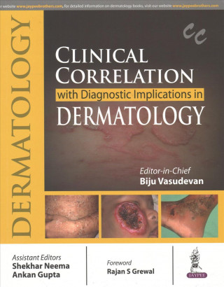Kniha Clinical Correlation with Diagnostic Implications in Dermatology Biju Vasudevan