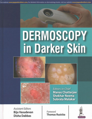 Buch Dermoscopy in Darker Skin Manas Chatterjee