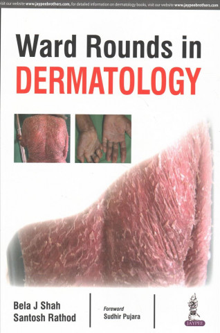 Книга Ward Rounds in Dermatology Bela J. Shah