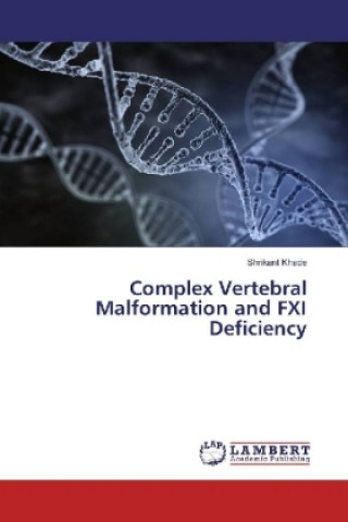 Buch Complex Vertebral Malformation and FXI Deficiency Shrikant Khade