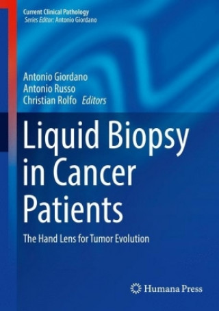 Carte Liquid Biopsy in Cancer Patients Antonio Giordano