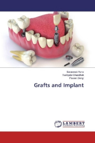 Book Grafts and Implant Saraswati Rana