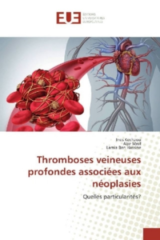 Knjiga Thromboses veineuses profondes associées aux néoplasies Ines Kechaou