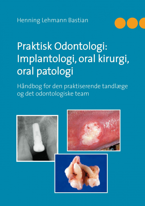 Kniha Praktisk Odontologi: Implantologi, oral kirurgi, oral patologi Henning Lehmann Bastian