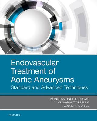 Kniha Endovascular Treatment of Aortic Aneurysms Konstantinos Donas