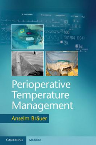 Könyv Perioperative Temperature Management Anselm Brauer