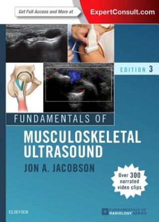 Kniha Fundamentals of Musculoskeletal Ultrasound Jon A. Jacobson