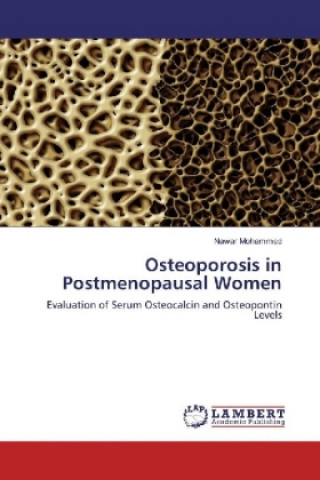 Kniha Osteoporosis in Postmenopausal Women Nawar Mohammed