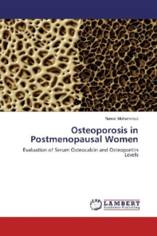 Buch Osteoporosis in Postmenopausal Women Nawar Mohammed