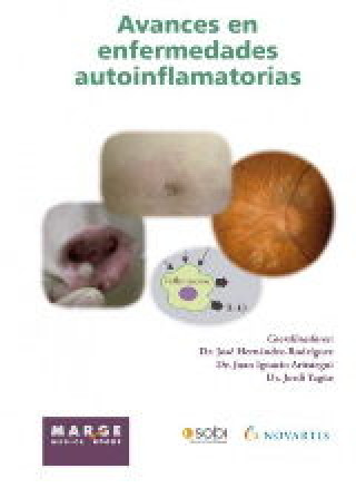 Könyv Avances en enfermedades autoinflamatorias 