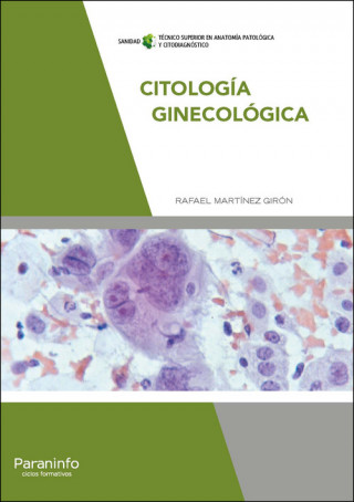 Kniha Citología ginecológica RAFAEL MARTINEZ GIRON