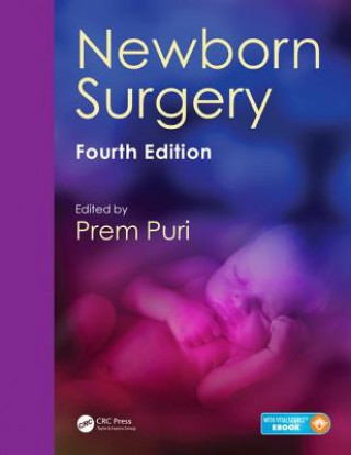 Kniha Newborn Surgery Prem Puri