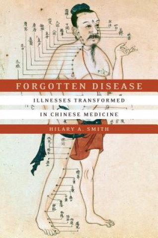Carte Forgotten Disease Hilary A. Smith