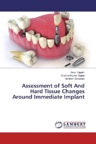 Książka Assessment of Soft And Hard Tissue Changes Around Immediate Implant Vivek Tripathi