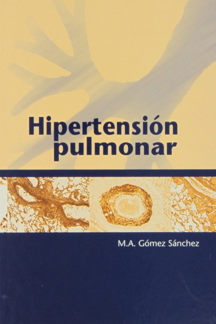 Book Hipertensión pulmonar 