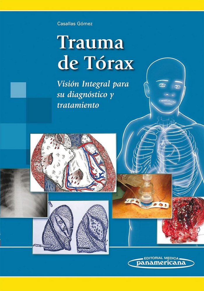 Kniha TRAUMA DE TÓRAX 